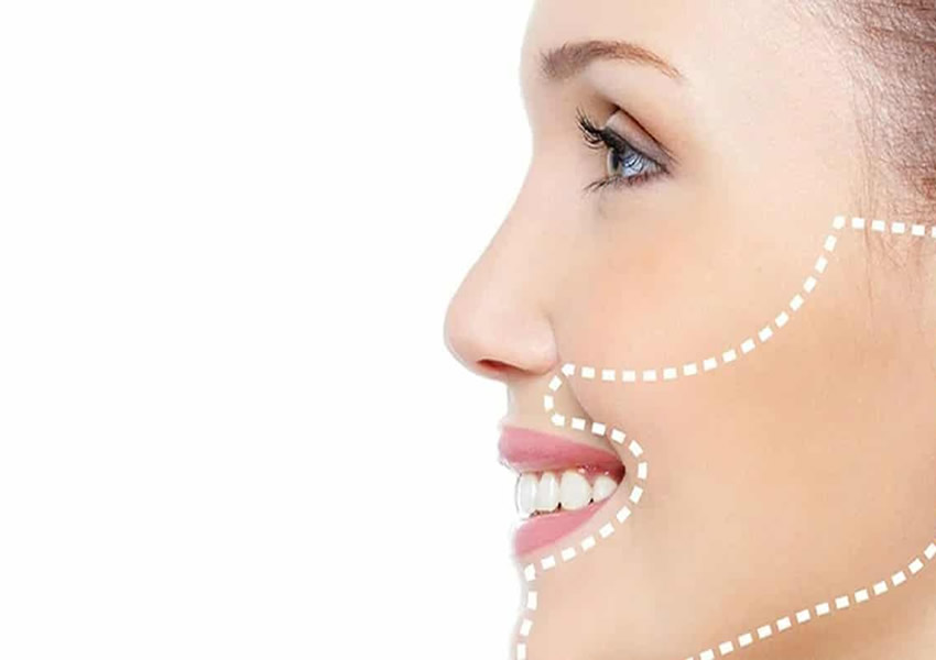 Çene Estetiği